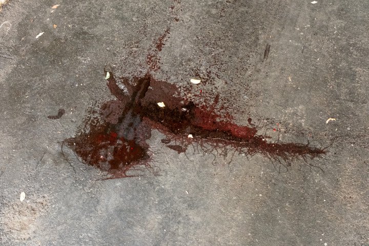 Viscera that had leaked from a body bag carrying an unidentified body. (Photo: Daniel Kosoy / UNITED24 Media)  