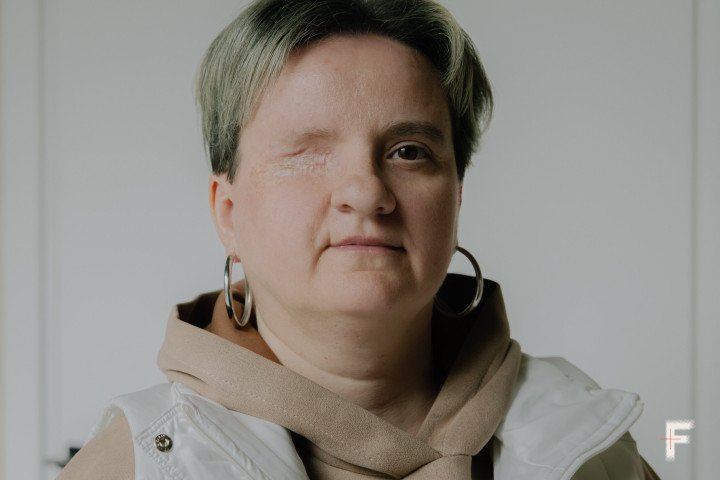 Patient Viktoriia Frolova, Lviv, Ukraine, April 15, 2026. (Anna Zubenko/Frontliner) Patient Viktoriia Frolova, Lviv, Ukraine, April 15, 2026. (Anna Zubenko/Frontliner)