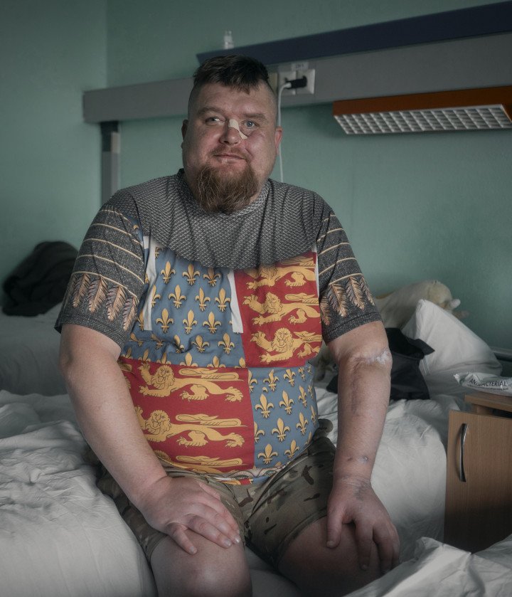 Artem Korchak recibió el distintivo de llamada "Batiushka" de sus compañeros. Esta no es su primera cirugía, pero sí la primera que le realizarán cirujanos extranjeros. Foto: Josh Olley/ UNITED24 Media