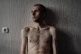 A Ukrainian soldier who was previously held captive poses for a portrait while undergoing rehabilitation on June 6, 2024 in Ukraine. (Source: Getty Images)